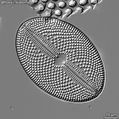 Image of a diatom